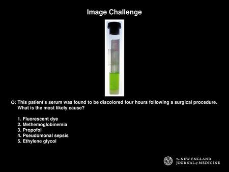 Image Challenge Q: This patient's serum was found to be discolored four hours following a surgical procedure. What is the most likely cause? 1. Fluorescent.