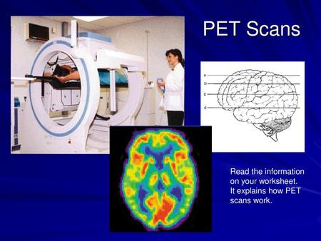 PET Scans Read the information on your worksheet. It explains how PET scans work.