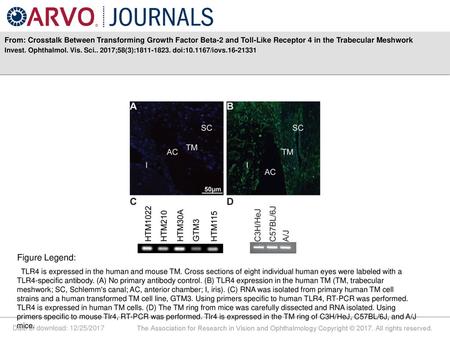 From: Crosstalk Between Transforming Growth Factor Beta-2 and Toll-Like Receptor 4 in the Trabecular Meshwork Invest. Ophthalmol. Vis. Sci.. 2017;58(3):1811-1823.