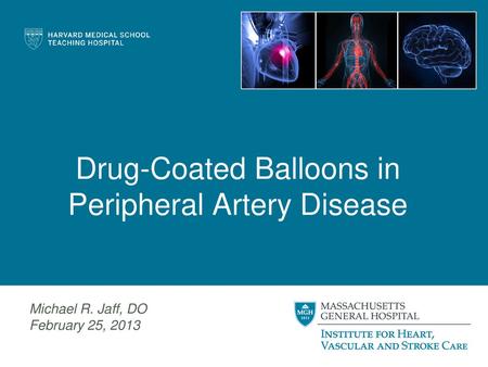 Drug-Coated Balloons in Peripheral Artery Disease