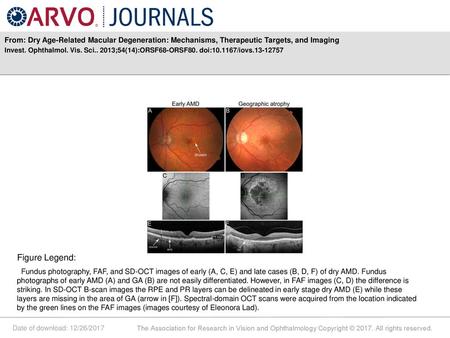 Invest. Ophthalmol. Vis. Sci ;54(14):ORSF68-ORSF80. doi: /iovs