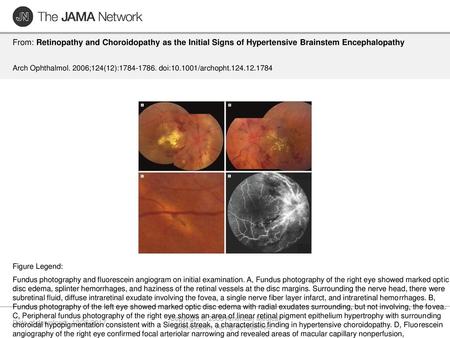 Copyright © 2006 American Medical Association. All rights reserved.