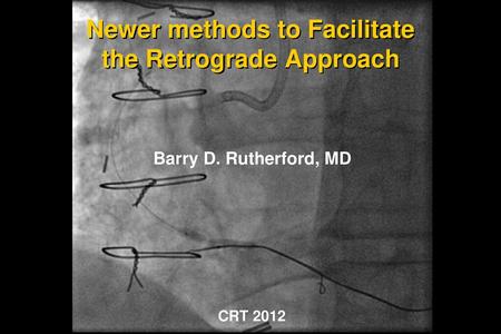 Newer methods to Facilitate the Retrograde Approach