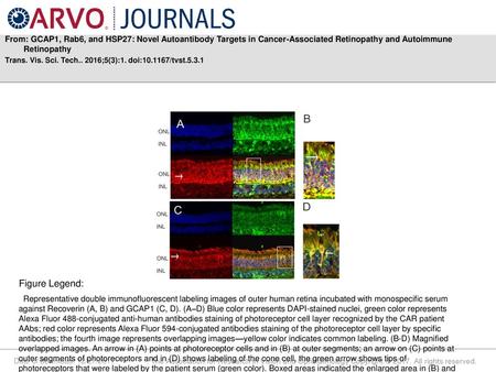 From: GCAP1, Rab6, and HSP27: Novel Autoantibody Targets in Cancer-Associated Retinopathy and Autoimmune Retinopathy Trans. Vis. Sci. Tech.. 2016;5(3):1.