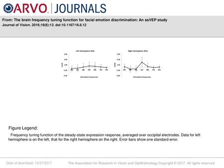 Journal of Vision. 2016;16(6):12. doi: / Figure Legend: