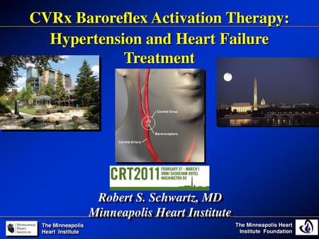 CVRx Baroreflex Activation Therapy: