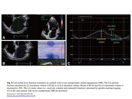 Fig. 5. Left atrium (LA) function evaluation in a patient with severe asymptomatic mitral regurgitation (MR). The LA ejection fraction calculated by LA.