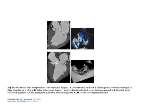 Fig year-old man who presented with exertional dyspnea. A