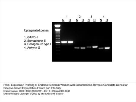 Figure 1. Equal cycle RT-PCR of selected genes up-regulated in eutopic human endometrium during the window of implantation, from women without (N) and.