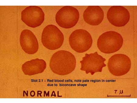 Slot 2.1 – Red blood cells, note pale region in center