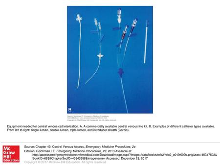 Equipment needed for central venous catheterization. A