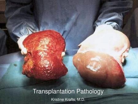 Transplantation Pathology