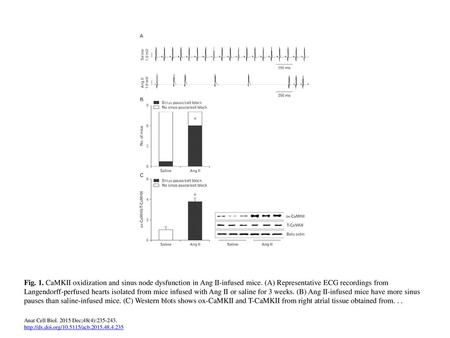 Fig. 1. CaMKII oxidization and sinus node dysfunction in Ang II-infused mice. (A) Representative ECG recordings from Langendorff-perfused hearts isolated.