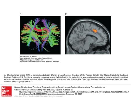 A. Diffusion tensor image (DTI) of connections between different areas of cortex. (Courtesy of Dr. Thomas Schultz, Max Planck Institute for Intelligent.