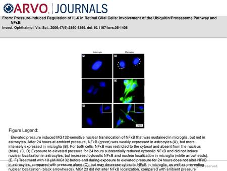 From: Pressure-Induced Regulation of IL-6 in Retinal Glial Cells: Involvement of the Ubiquitin/Proteasome Pathway and NFκB Invest. Ophthalmol. Vis. Sci..