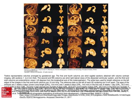 Twelve representative volumes arranged by gestational age