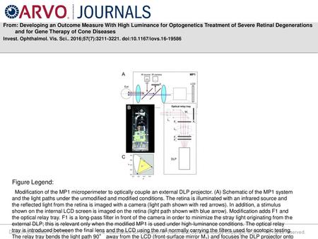 From: Developing an Outcome Measure With High Luminance for Optogenetics Treatment of Severe Retinal Degenerations and for Gene Therapy of Cone Diseases.