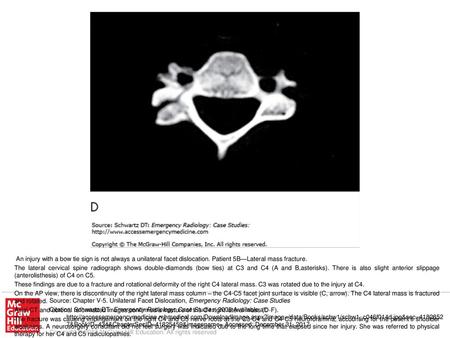 [From: Galli : et al: Emergency Orthopedics: The Spine