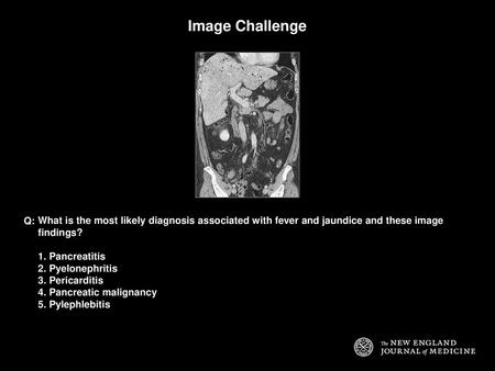 Image Challenge Q: What is the most likely diagnosis associated with fever and jaundice and these image findings? 1. Pancreatitis 2. Pyelonephritis 3.