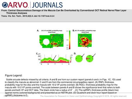 From: Central Glaucomatous Damage of the Macula Can Be Overlooked by Conventional OCT Retinal Nerve Fiber Layer Thickness Analyses Trans. Vis. Sci. Tech..