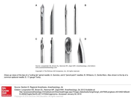 Close-up views of the tips of a cutting-tip spinal needle: A