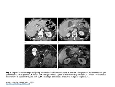 Fig year-old male with pathologically confirmed ductal adenocarcinoma