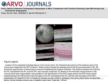 From: Optical Coherence Tomography Angiography in Mice: Comparison with Confocal Scanning Laser Microscopy and Fluorescein Angiography Trans. Vis. Sci.