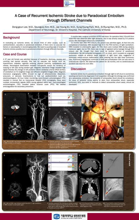 A Case of Recurrent Ischemic Stroke due to Paradoxical Embolism through Different Channels Dong-geun Lee, M.D., Seungyoo Kim, M.D., Jae Young An, M.D.,