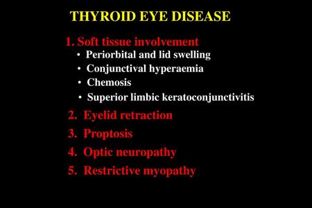 THYROID EYE DISEASE 1. Soft tissue involvement 2. Eyelid retraction