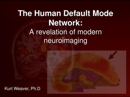 The Human Default Mode Network: A revelation of modern neuroimaging