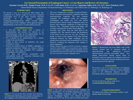 An Unusual Presentation of Esophageal Cancer: A Case Report and Review of Literature. Abraham Yacoub M.D.1, Regina Frants, M.D., F.A.C.P.2, Leslie Bank,