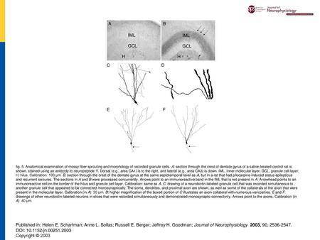 Fig. 5. Anatomical examination of mossy fiber sprouting and morphology of recorded granule cells. A: section through the crest of dentate gyrus of a saline-treated.