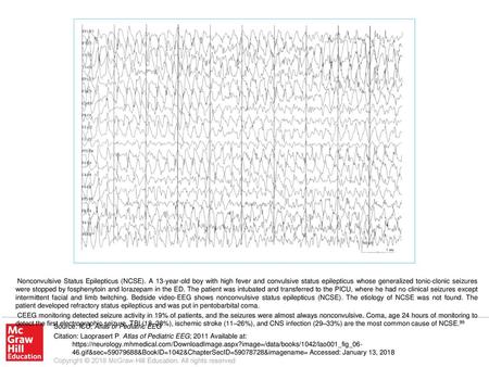 CEEG monitoring detected seizure activity in 19% of patients, and the seizures were almost always nonconvulsive. Coma, age 24 hours of monitoring to detect.