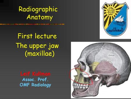 The upper jaw (maxillae)