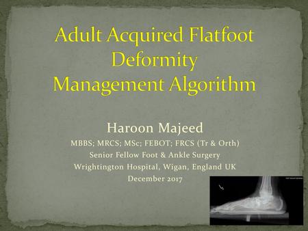 Adult Acquired Flatfoot Deformity Management Algorithm