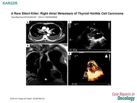 A Rare Silent Killer: Right Atrial Metastasis of Thyroid Hürthle Cell Carcinoma Case Rep Oncol 2015;8:233-237 - DOI:10.1159/000430948 Fig. 1. The patient.