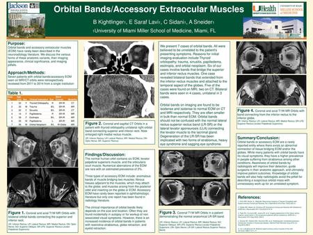 Orbital Bands/Accessory Extraocular Muscles