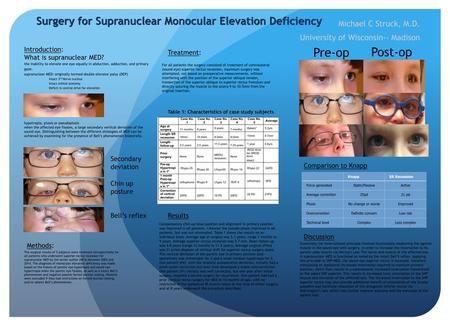 Surgery for Supranuclear Monocular Elevation Deficiency