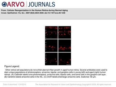 From: Cellular Reorganization in the Human Retina during Normal Aging