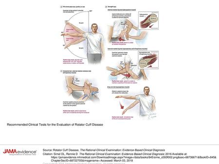 Recommended Clinical Tests for the Evaluation of Rotator Cuff Disease