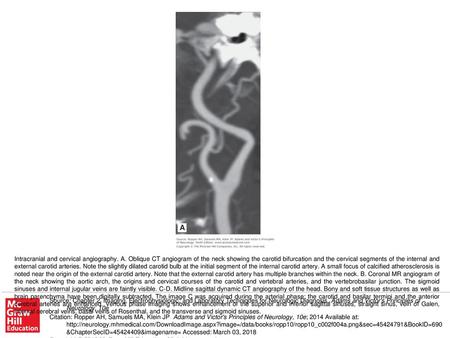 Intracranial and cervical angiography. A