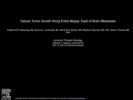 Tubular Tumor Growth Along Entire Biopsy Track of Brain Metastasis