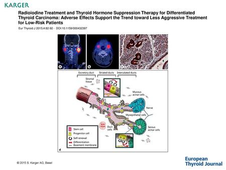 Radioiodine Treatment and Thyroid Hormone Suppression Therapy for Differentiated Thyroid Carcinoma: Adverse Effects Support the Trend toward Less Aggressive.