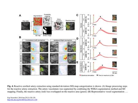 Fig. 4. Reactive cerebral artery extraction using standard deviation (SD) map categorization is shown. (A) Image processing steps for the reactive artery.