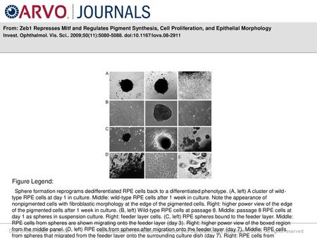 From: Zeb1 Represses Mitf and Regulates Pigment Synthesis, Cell Proliferation, and Epithelial Morphology Invest. Ophthalmol. Vis. Sci.. 2009;50(11):5080-5088.