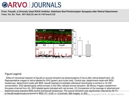 From: Fasudil, a Clinically Used ROCK Inhibitor, Stabilizes Rod Photoreceptor Synapses after Retinal Detachment Trans. Vis. Sci. Tech.. 2017;6(3):22. doi:10.1167/tvst.6.3.22.