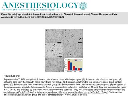 From: Nerve Injury-related Autoimmunity Activation Leads to Chronic Inflammation and Chronic Neuropathic Pain Anesthes. 2013;118(2):416-429. doi:10.1097/ALN.0b013e31827d4b82.