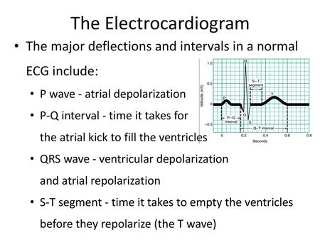 The Electrocardiogram