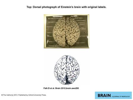 Top: Dorsal photograph of Einstein’s brain with original labels.