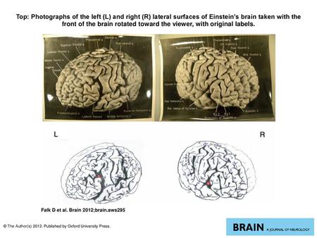 Top: Photographs of the left (L) and right (R) lateral surfaces of Einstein’s brain taken with the front of the brain rotated toward the viewer, with original.